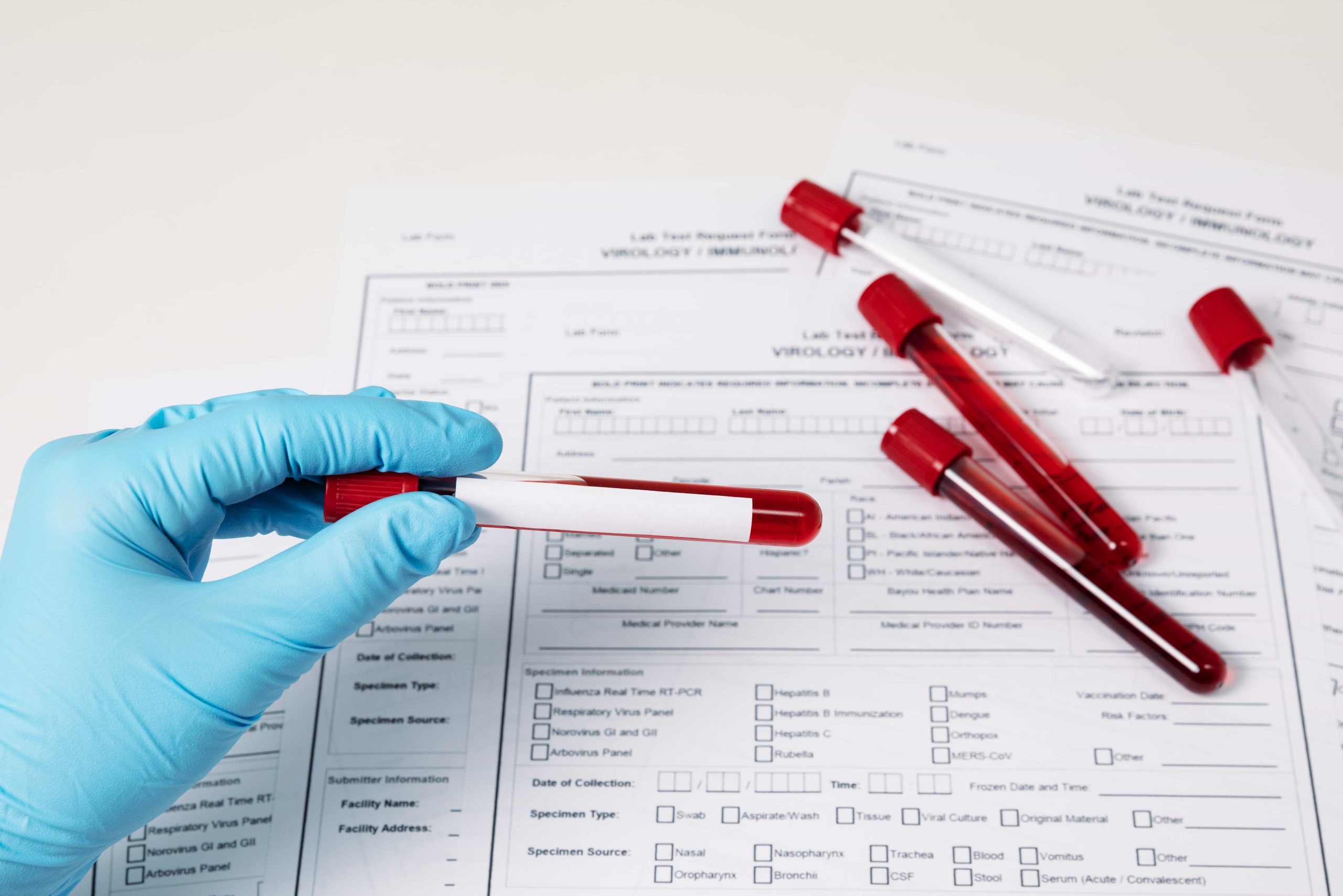 Complete Blood Count (CBC): Key Insights for Your Health